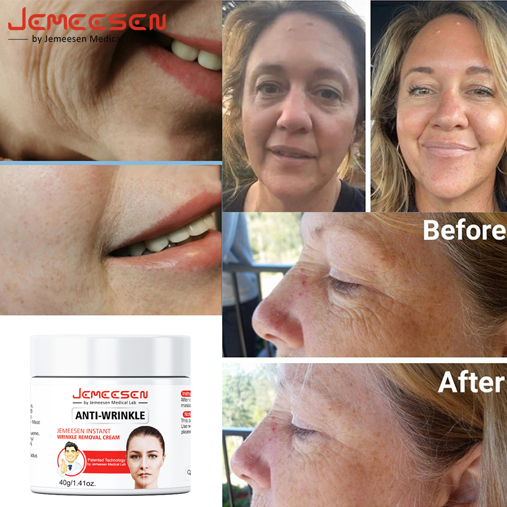 Jemeesen Retinol Lifting Firming Cream Remove Wrinkle Anti-Aging Fade Fine Lines Face Whitening Brighten Skin Beauty Health Care