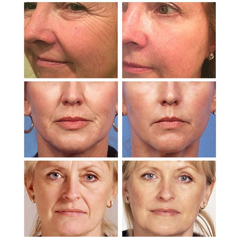 Jemeesen Retinol Lifting Firming Cream Remove Wrinkle Anti-Aging Fade Fine Lines Face Whitening Brighten Skin Beauty Health Care