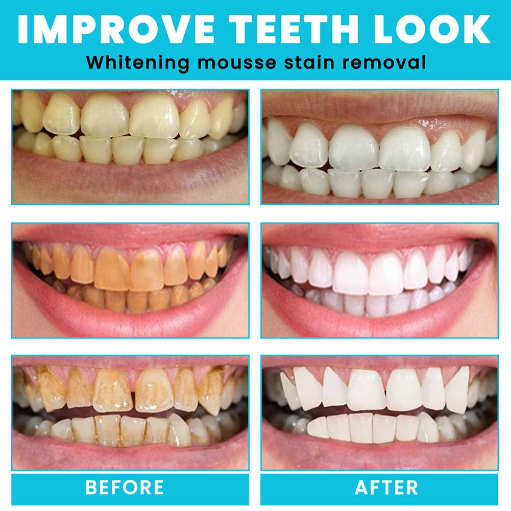 Whitening Foam Toothpaste