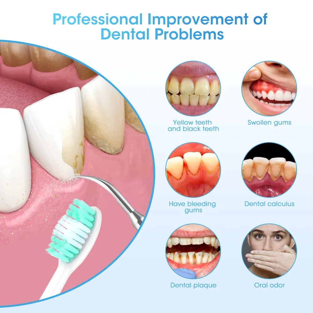 Electric Teeth Whitening Dental Tartar Scaler Coffee Plaque Stain Tartar Removal High Frequency Sonic Toothbrush Teeth Cleaner Electric Teeth Whitening Dental Tartar Scaler Coffee Plaque Stain Tartar Removal High Frequency Sonic Toothbrush Teeth Cleaner